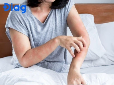 Ký sinh trùng trên da người những điều cần biết và cách xử lý