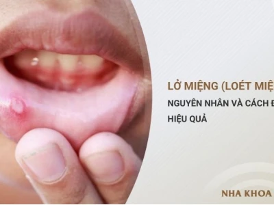 Lở Mồm Ở Người: Nguyên Nhân, Triệu Chứng Và Cách Điều Trị Hiệu Quả