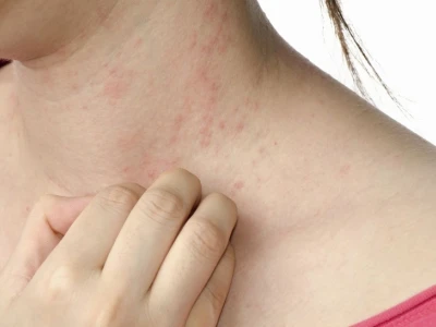 Ngứa khắp người không rõ nguyên nhân: Nguyên nhân và cách khắc phục hiệu quả