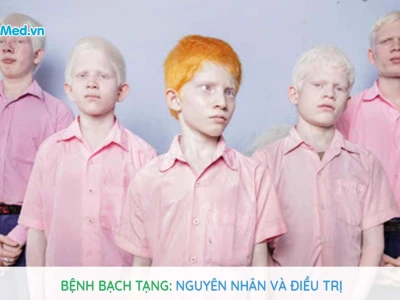 Người Bạch Tạng Ở Việt Nam: Đặc Điểm, Nguyên Nhân Và Cách Chăm Sóc