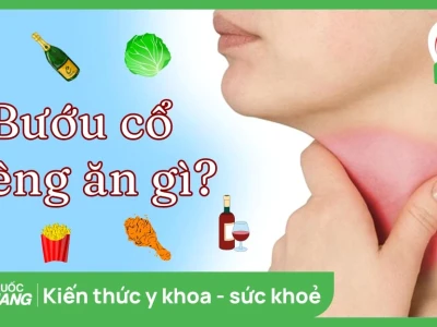 Người bị bướu cổ nên kiêng ăn gì và ăn gì tốt cho tuyến giáp?