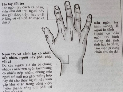 Người có 6 ngón tay: Giải mã ý nghĩa nhân tướng học và vận mệnh