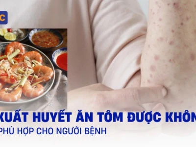 Người lớn sốt ăn tôm được không: Giải đáp chi tiết từ chuyên gia