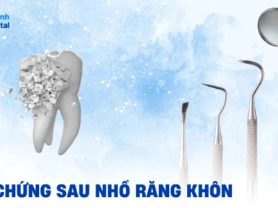 Nhổ răng khôn chết người: Nguy cơ tiềm ẩn và cách phòng tránh