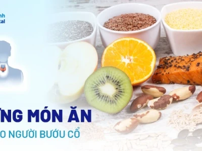 Những món ăn tốt cho người bị bướu cổ: Lựa chọn dinh dưỡng tối ưu