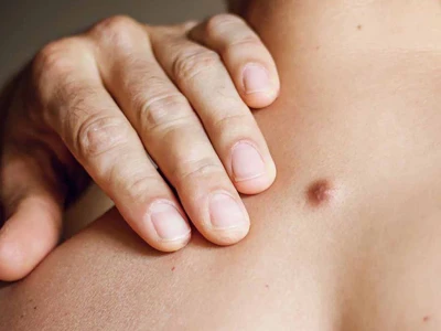 Nổi Cục Cứng Dưới Da: Tìm Hiểu Nguyên Nhân Và Cách Xử Lý Hiệu Quả