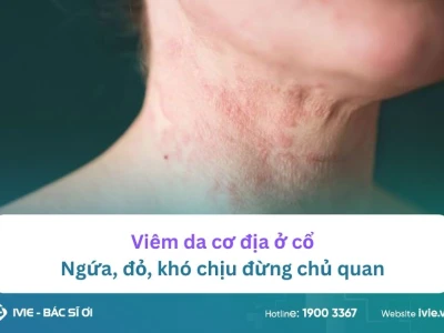 Nổi mẩn đỏ ở cổ người lớn: Nguyên nhân, triệu chứng và cách xử lý