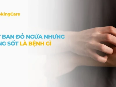 Nóng phát ban ở người lớn: Nguyên nhân, triệu chứng và cách xử lý hiệu quả