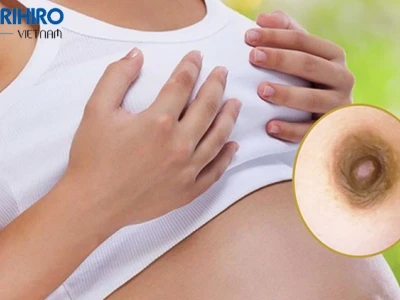 Núm vú đen: Nguyên nhân, dấu hiệu và cách khắc phục hiệu quả