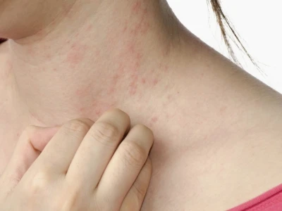 Tại sao bị ngứa khắp người? Nguyên nhân và cách khắc phục hiệu quả