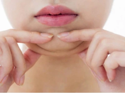 Tại sao người gầy vẫn có thể có khuôn mặt béo?