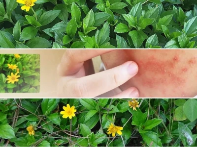 Sài Đất Công Dụng Kháng Viêm Dân Gian