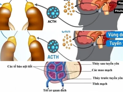 Trục Hạ Đồi Tuyến Yên Thượng Thận Điều Hòa Hormone Stress