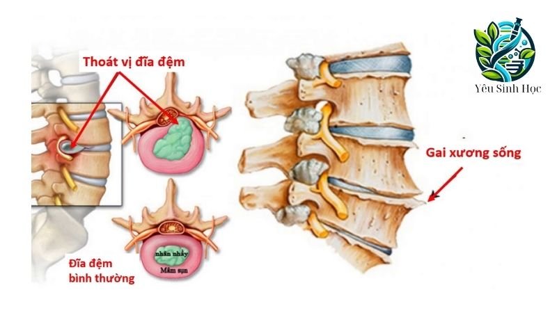 cấu tạo dây thân kinh tuỷ