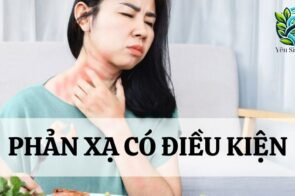 Phản xạ có điều kiện ở cơ thể người