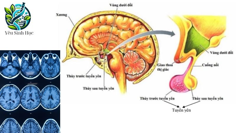 cấu tạo tuyến yên