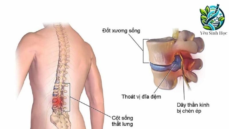 xương cột sống