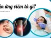 Phản ứng viêm là gì? Cơ chế và tác động đến sức khỏe con người